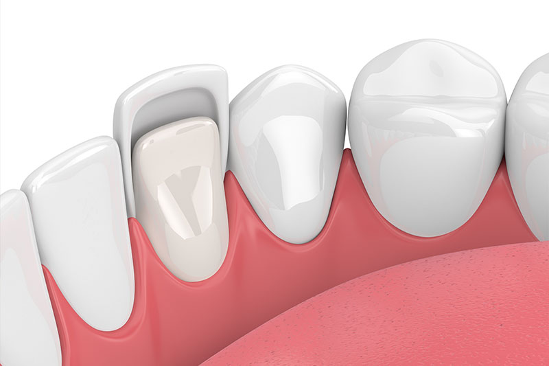 Cosmetic Dentistry in Cincinnati